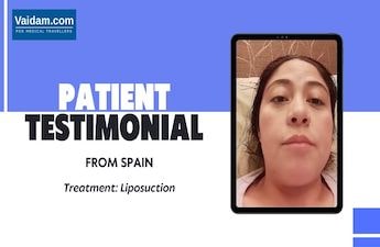 Spain Resident shares her experience on Liposuction Surgery in Turkey