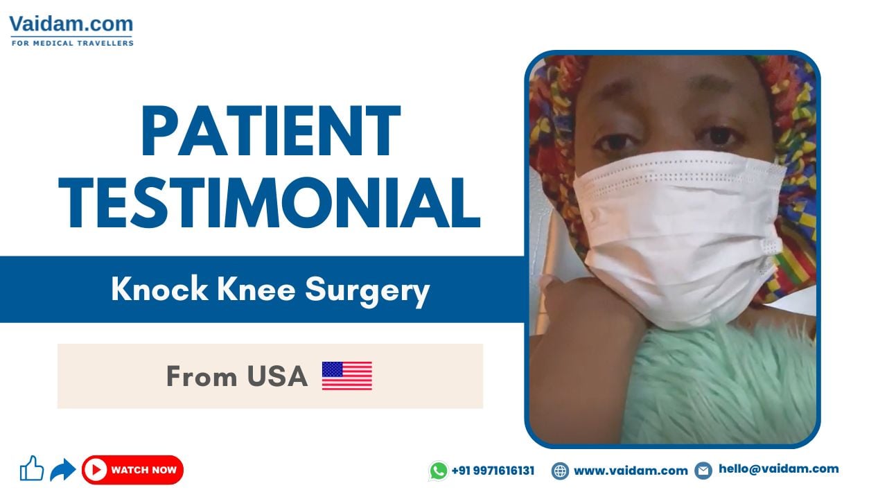 Knock Knee Surgery in Turkey | Happy patient shares her treatment experience with Vaidam.