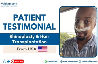 Successful Rhinoplasty and Hair Transplant in Turkey | Our Satisfied Patient from the United States