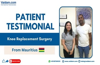 Patient from Mauritius Finds Relief from Arthritis | Robotic Knee Replacement Surgery in India