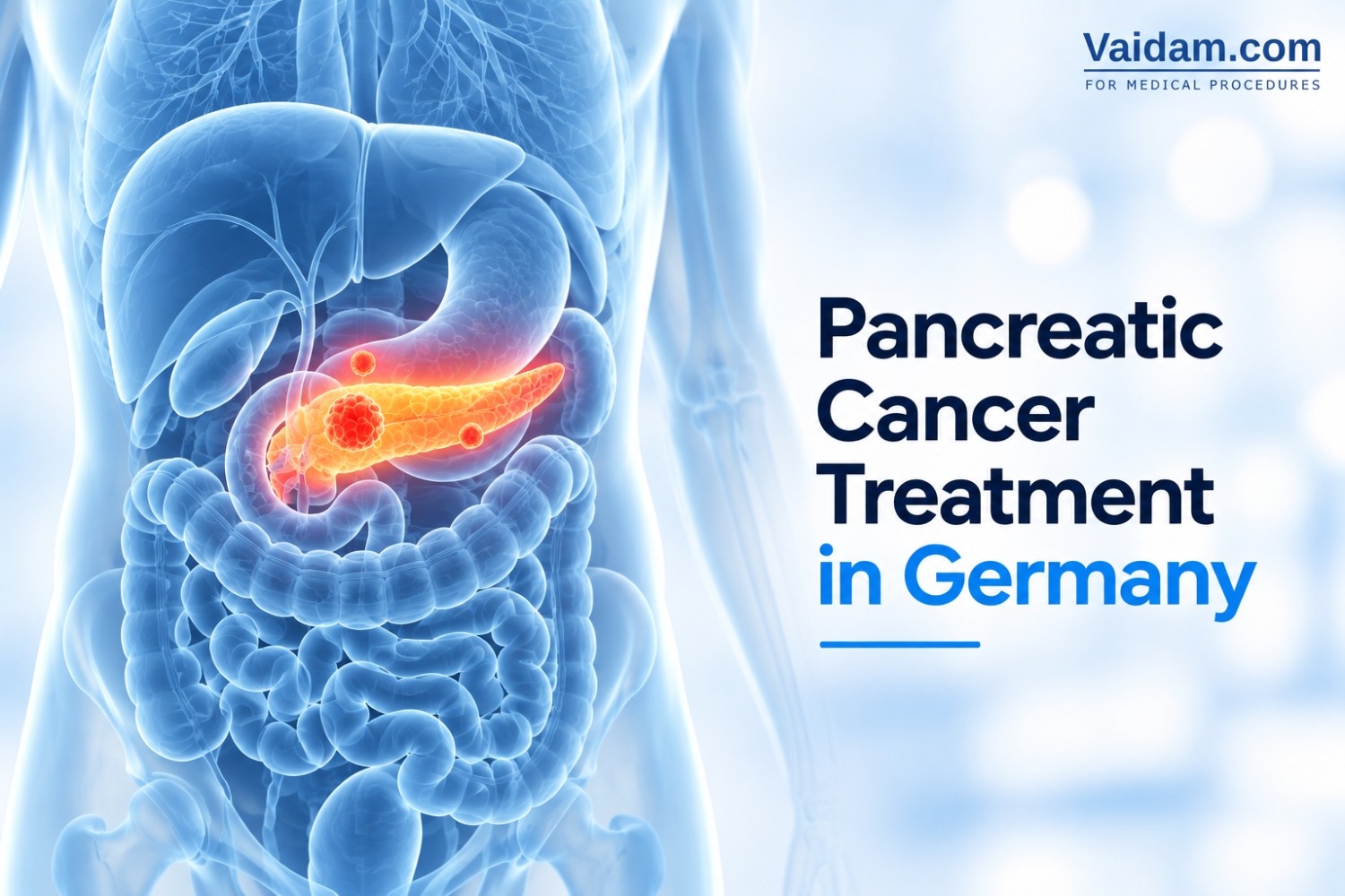 Pancreatic Cancer Treatment in Germany | Surgery & Cost