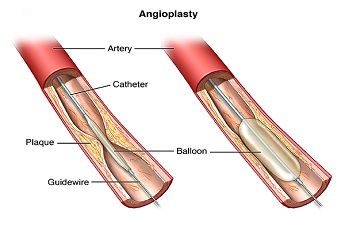 Keep Blood Vessels Healthy with Vascular Surgeon Dr. Manar Chikh Trab