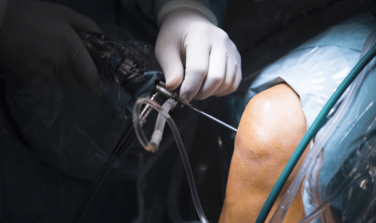 how to avoid ortho surgery