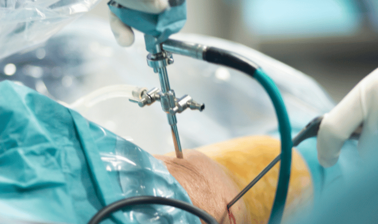 why do you need orthopedic surgery