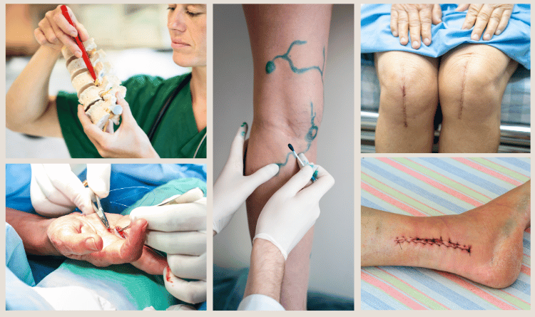 subspecialties of orthopedic surgery