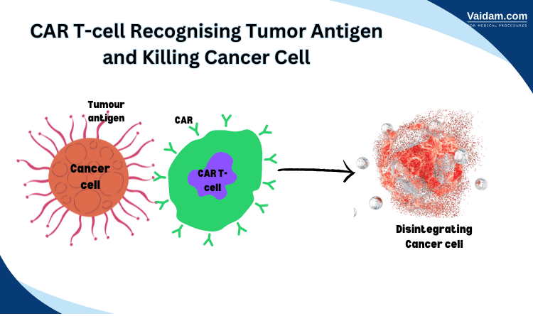 CAR t cell attacking cancer cells