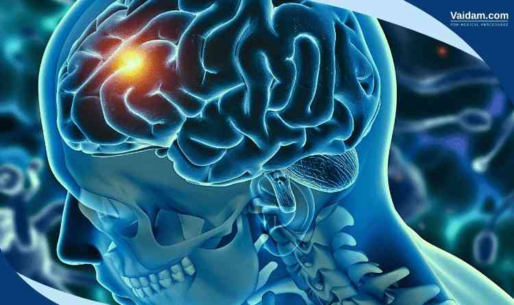 Representation of skull base tumour surgery
