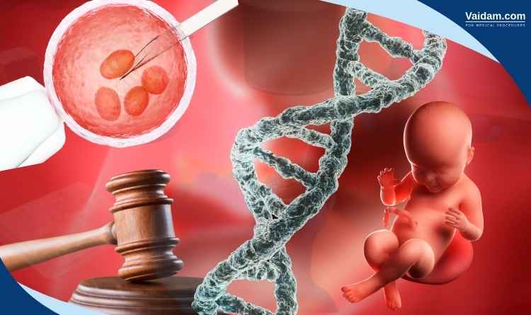 Image showing IVF and legal complications