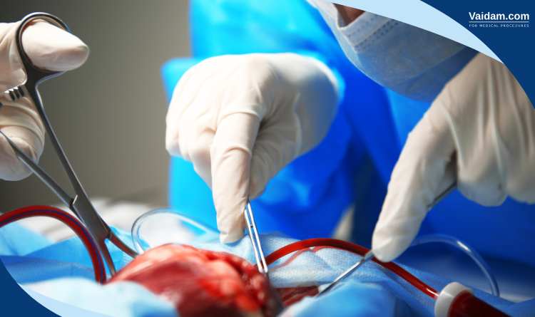 Heart surgery
