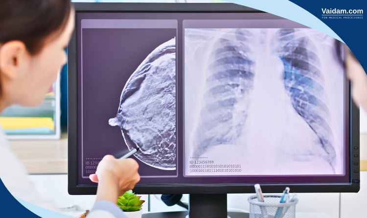Doctor discussing x-ray with the patient