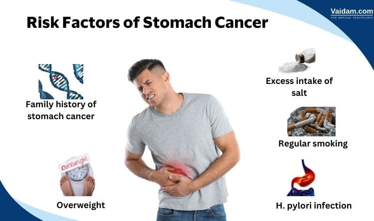 risks of stomach cancer