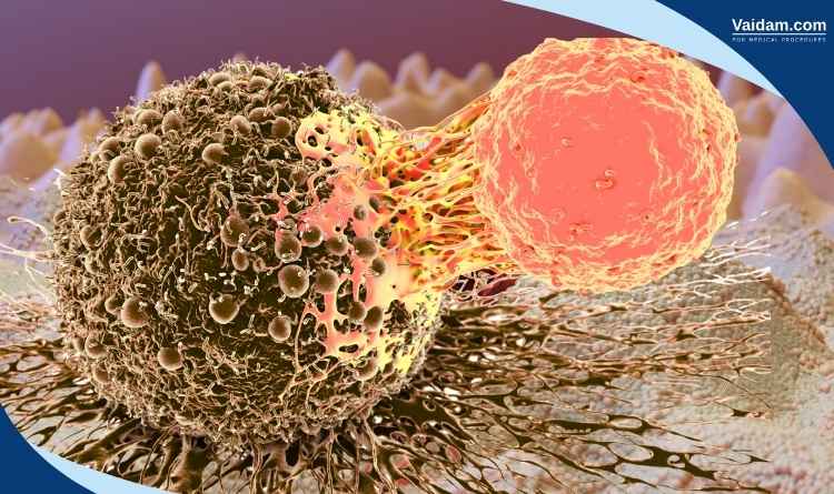 CAR T-cell in the body