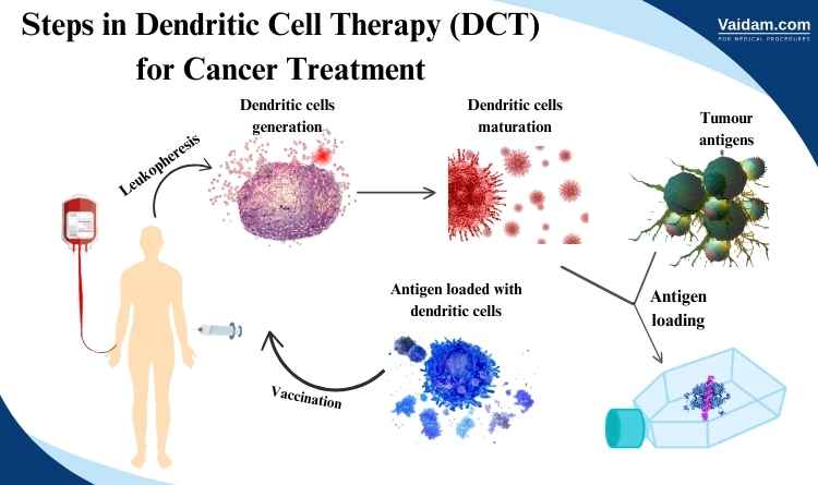 Steps in administration of dendritic cell therapy in Germany