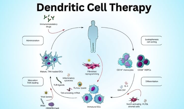 steps in dendritic cell therapy