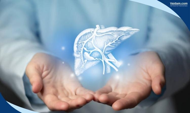 Liver Transplant in India