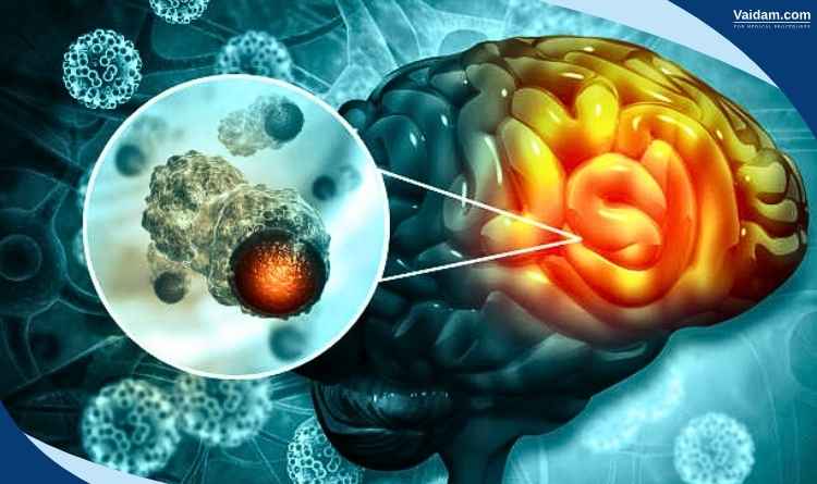 Surgical and Non-Surgical Interventions
