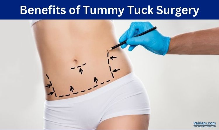 Benefits of Tummy Tuck Surgery