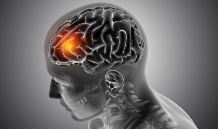 Brain Tumor is not Curable