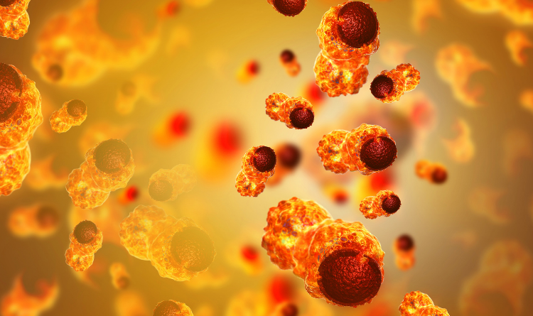Cancer develop within the body