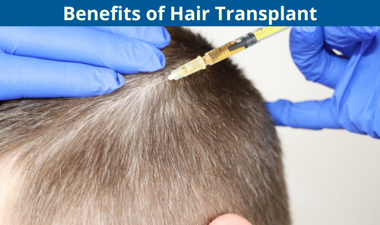 Hair transplant
