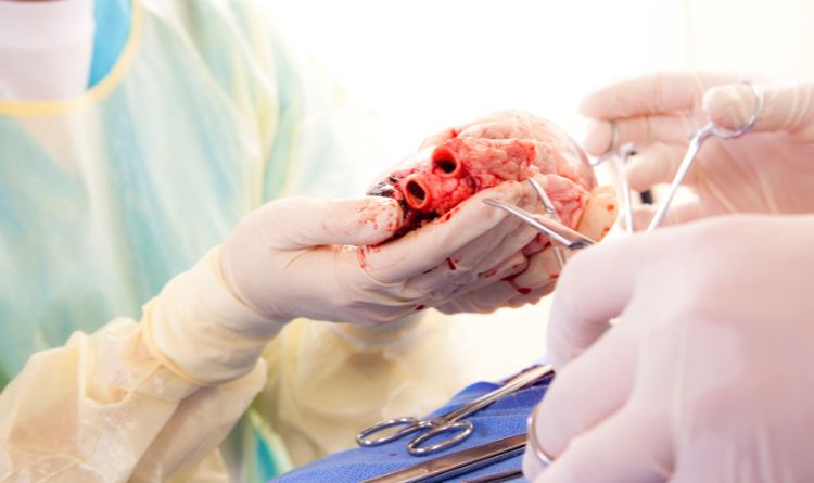 Is CABG Better than Stents