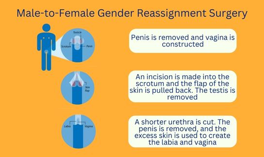 Male To Female