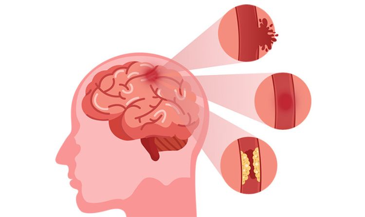 Neurosurgery symptoms