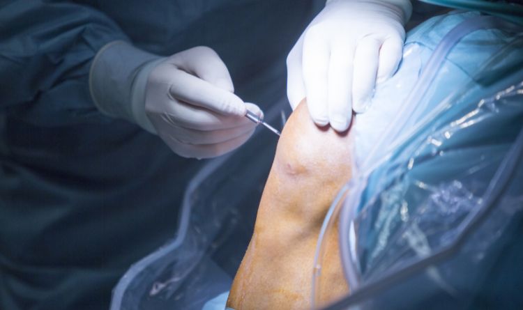 Recovery time after ACL surgery