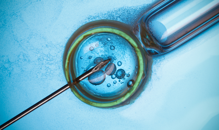Steps of IVF