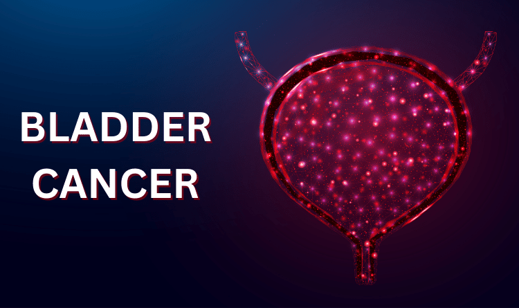 Bladder Cancer