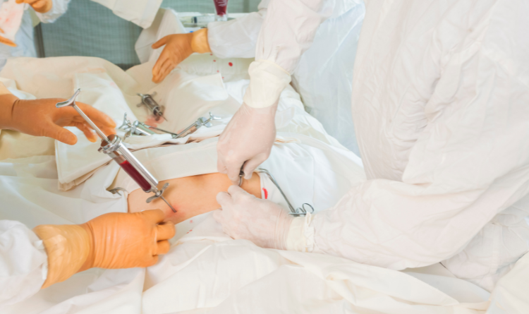 bone-marrow-transplant