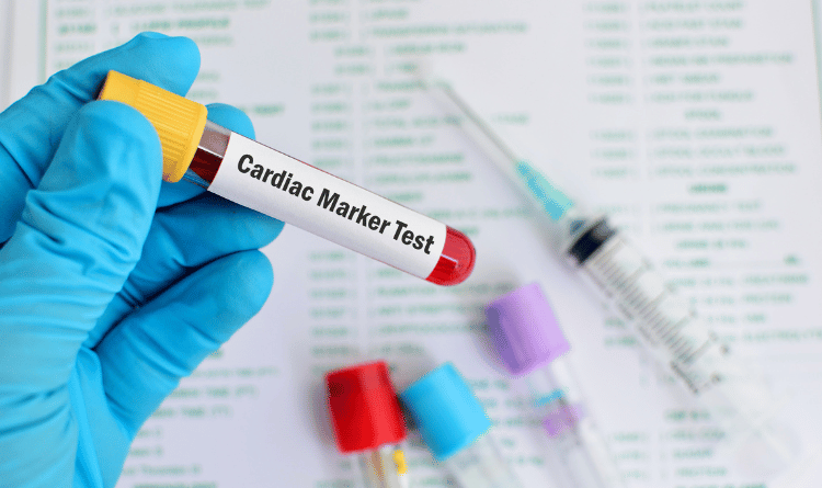 cardiac biomarker test