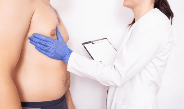 gynecomastia