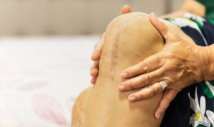 Knee Replacement