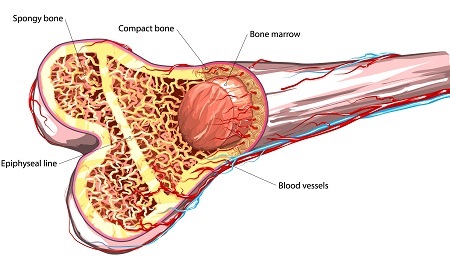 Bone Marrow Transplant