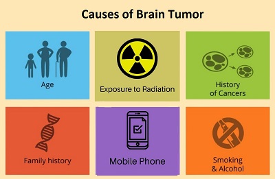 Causes of brain tumor