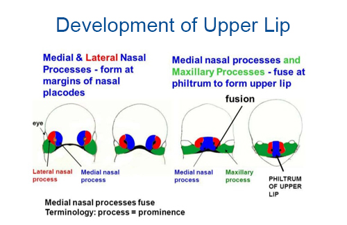 Development of upper lip Development of upper lip