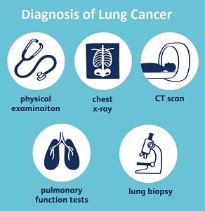 Diagnosis of lung cancer