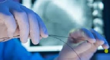 Aurangabad Doctors Performed Angioplasty through the Hand Aurangabad Doctors Performed Angioplasty through the Hand