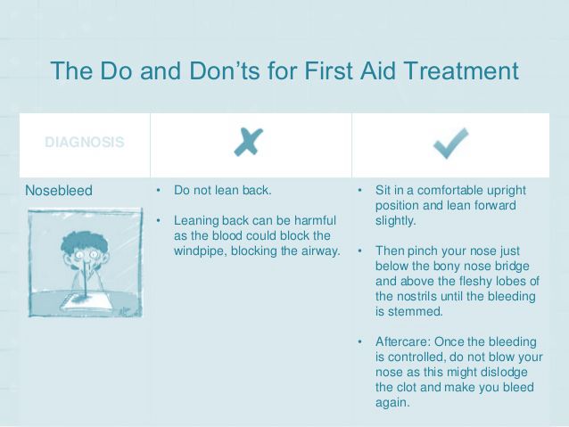 Do's and Dont's of Epistaxis