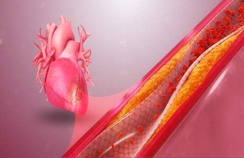 ECG test cost - Vaidam ECG test cost - Vaidam