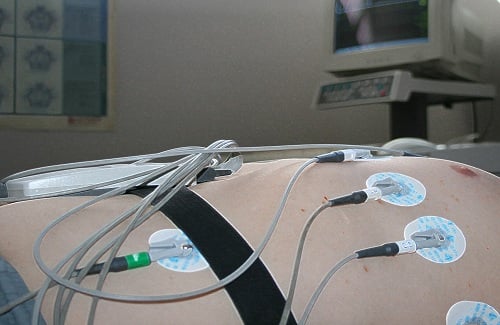 ECG test cost - Vaidam ECG test cost - Vaidam