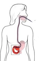 Endoscopy