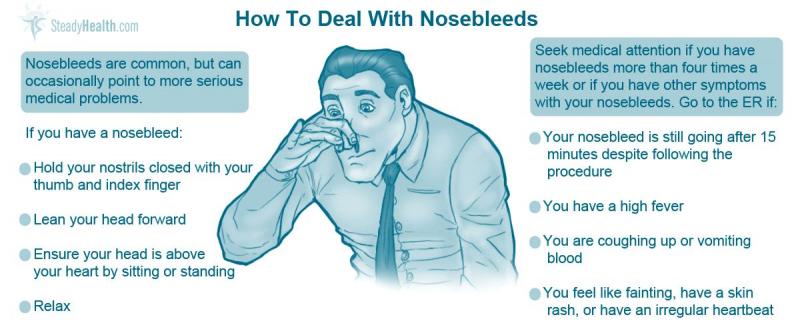 Epistaxis