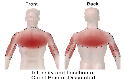 location of chest pain location of chest pain