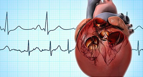 Heart transplant cost in Hyderabad Heart transplant cost in Hyderabad