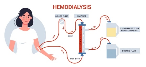 Preparation for Dialysis