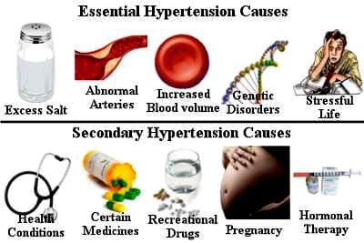 Essential Hypertension Causes