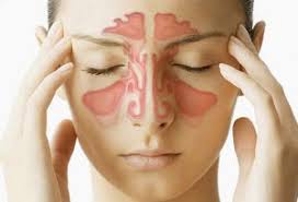 Chronic Sinusitis