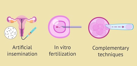 Infertility Treatment